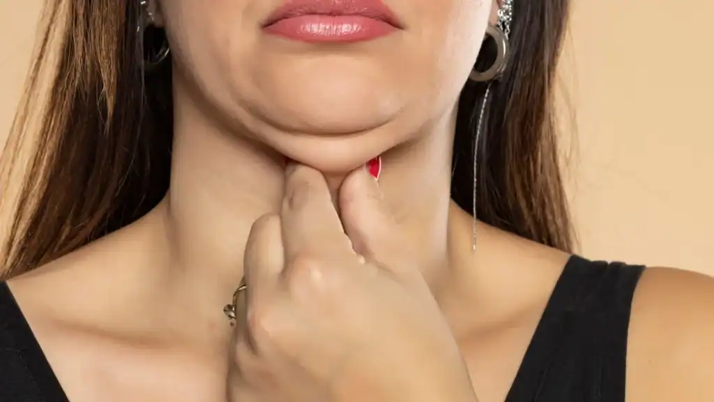 An image of a woman with double chin, sad, worried : Non Surgical Double Chin Removal Treatment in Almondsbury, UK