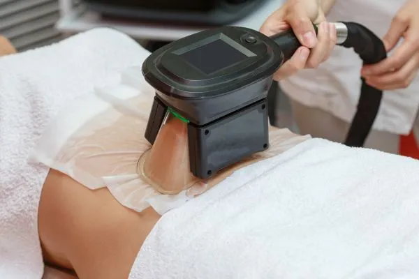 Image of person having fat freezing treatment to help weight gain Almondsbury