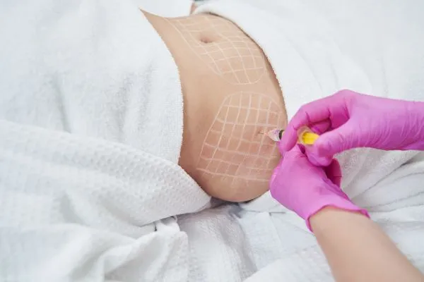 image of fat dissolving injections on love handles to help combat weight gain Almondsbury