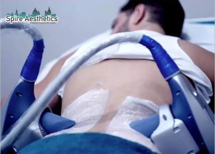 Man having fat freezing treatment done on love handles before a competitions Almondsbury to create a sculpted look.